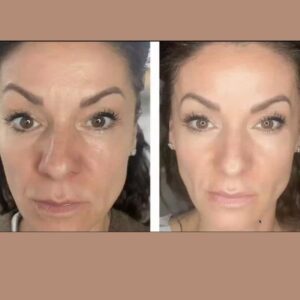 Antes y después limpieza facial LumiSpa iO piel madura 3