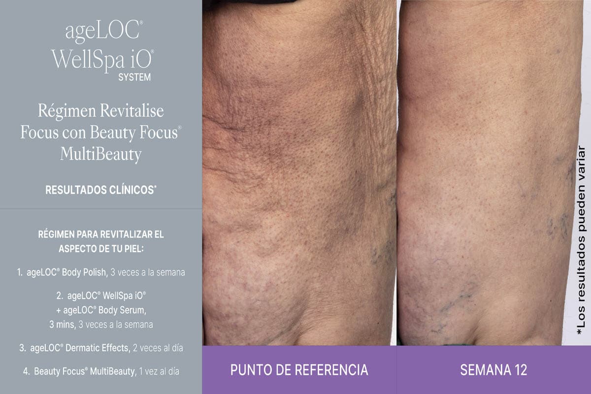 WellSPA iO antes y después