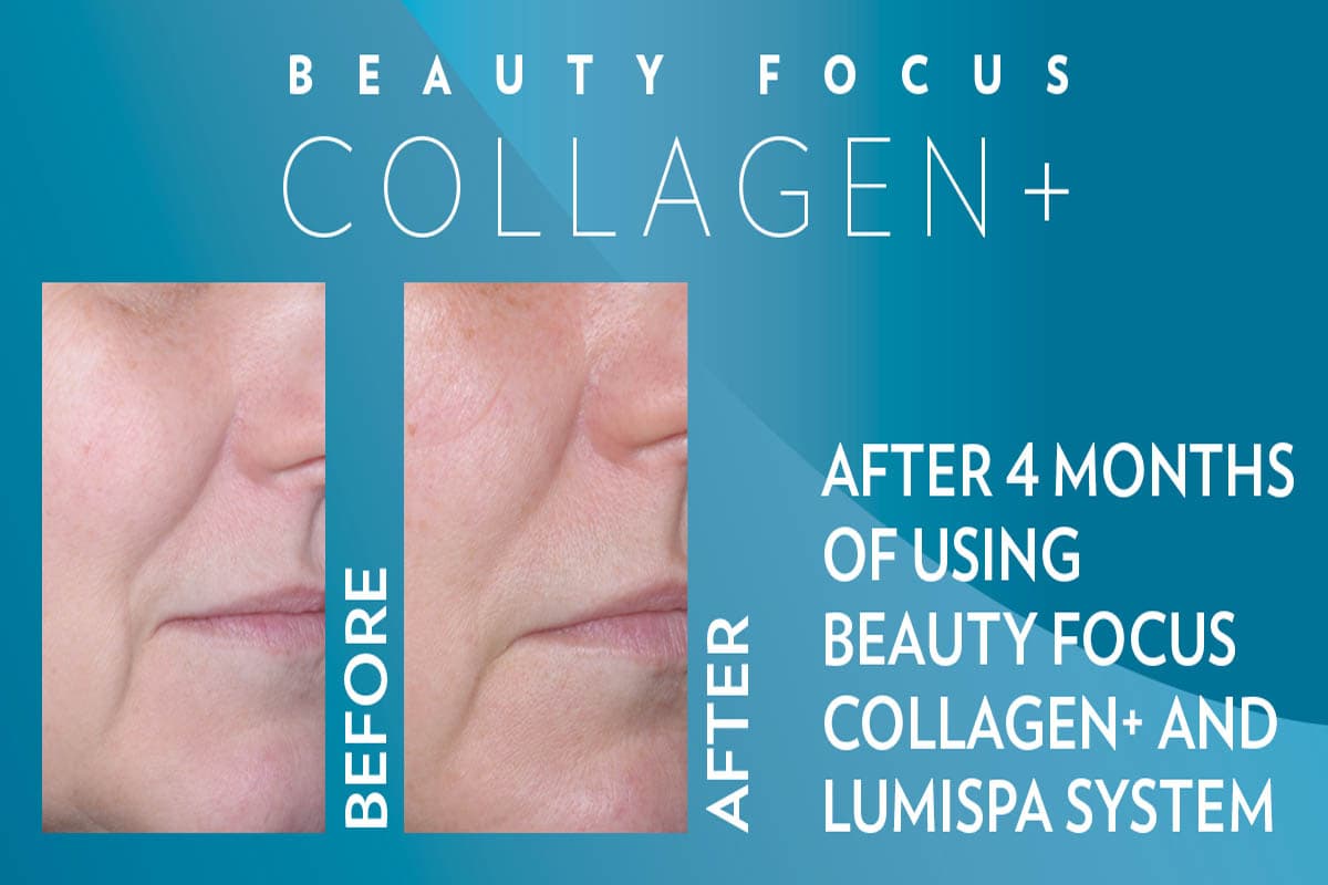 Resultados visibles tras 12 semanas usando ageLOC LumiSpa y Beauty Focus Collagen+