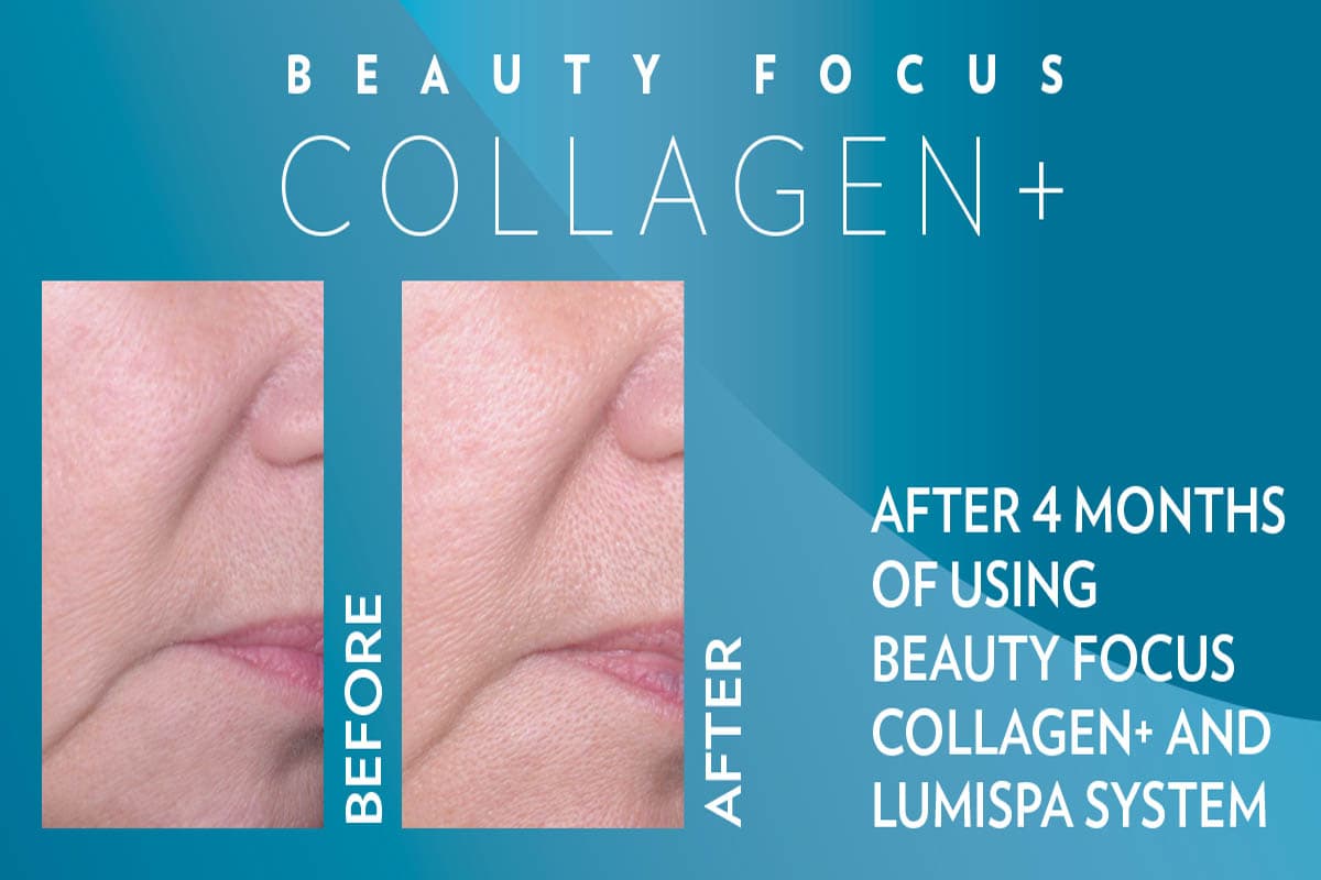 Antes y después del uso del dispositivo ageLOC LumiSpa con suplemento Beauty Focus Collagen+