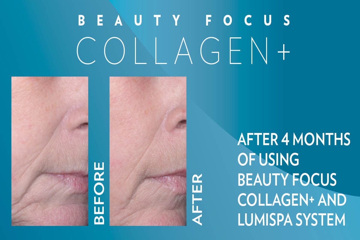 Resultados en luminosidad y firmeza después de 12 semanas con LumiSpa y Collagen+
