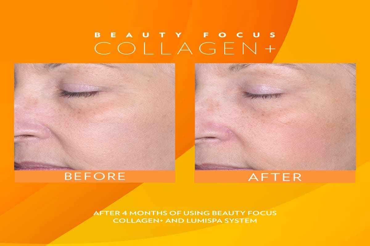 Beauty Focus Collagen+ antes y después