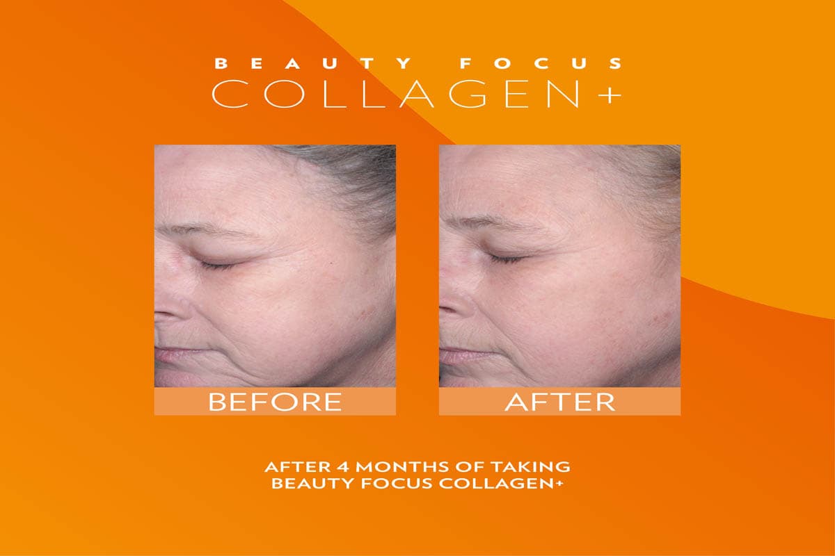 Estudios sobre el envejecimiento: Beauty Focus Collagen+