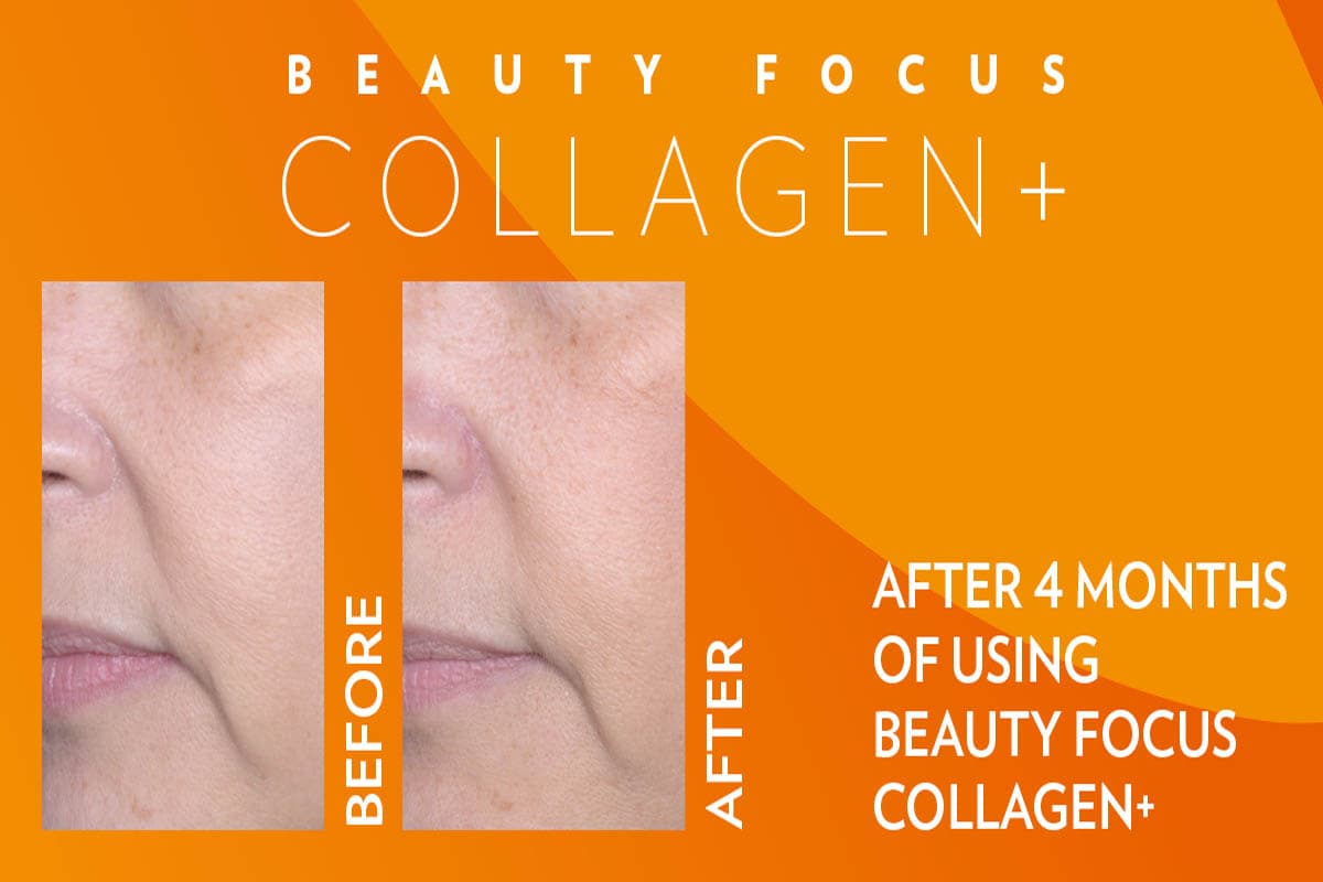Beauty Focus Collagen+ antes y después