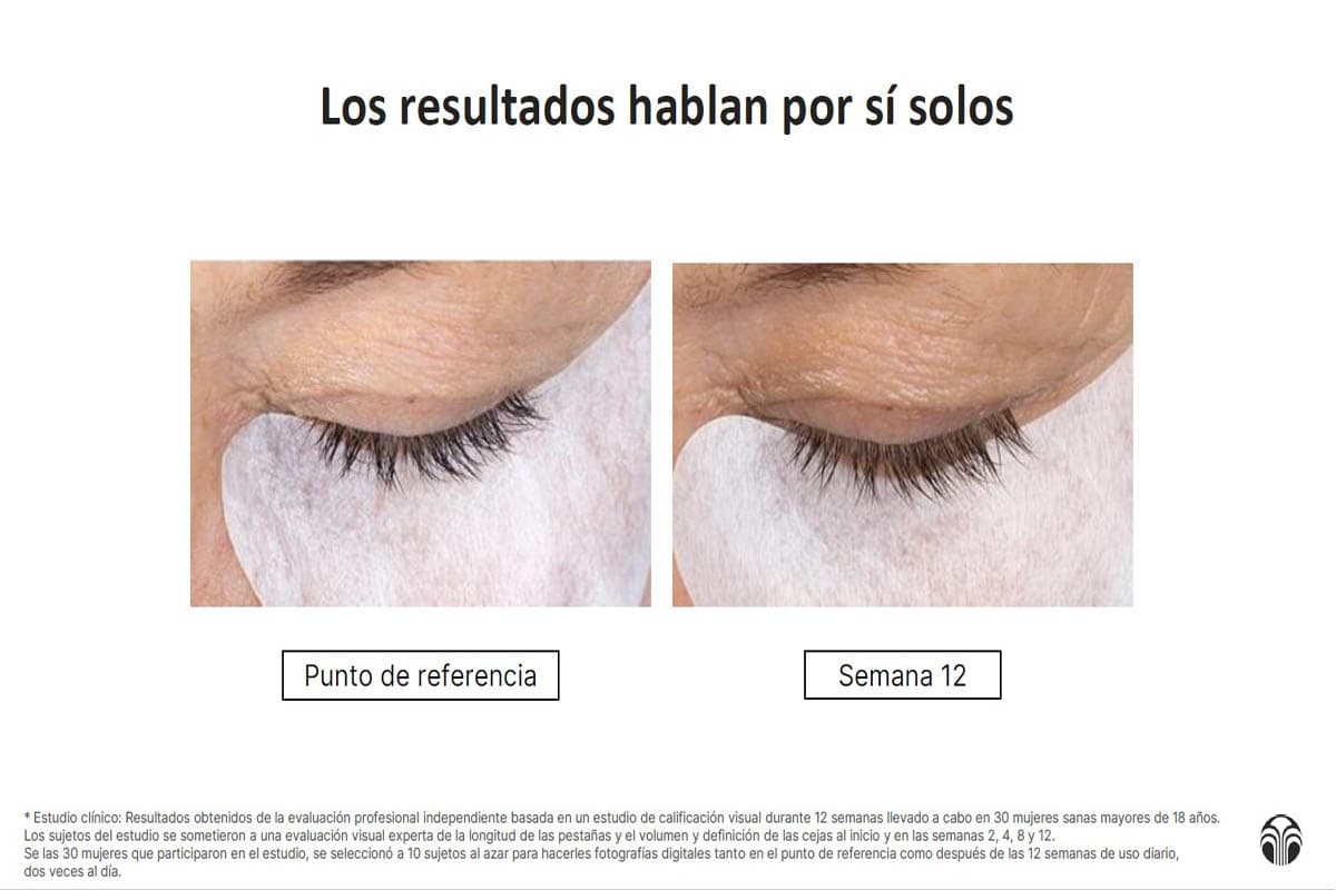Antes y después tras 12 semanas de uso del Nu Colour Lash + Brow Serum