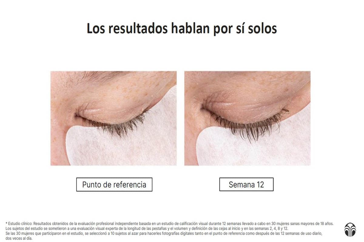 Segundo caso de antes y después tras 12 semanas de uso del Nu Colour Lash + Brow Serum