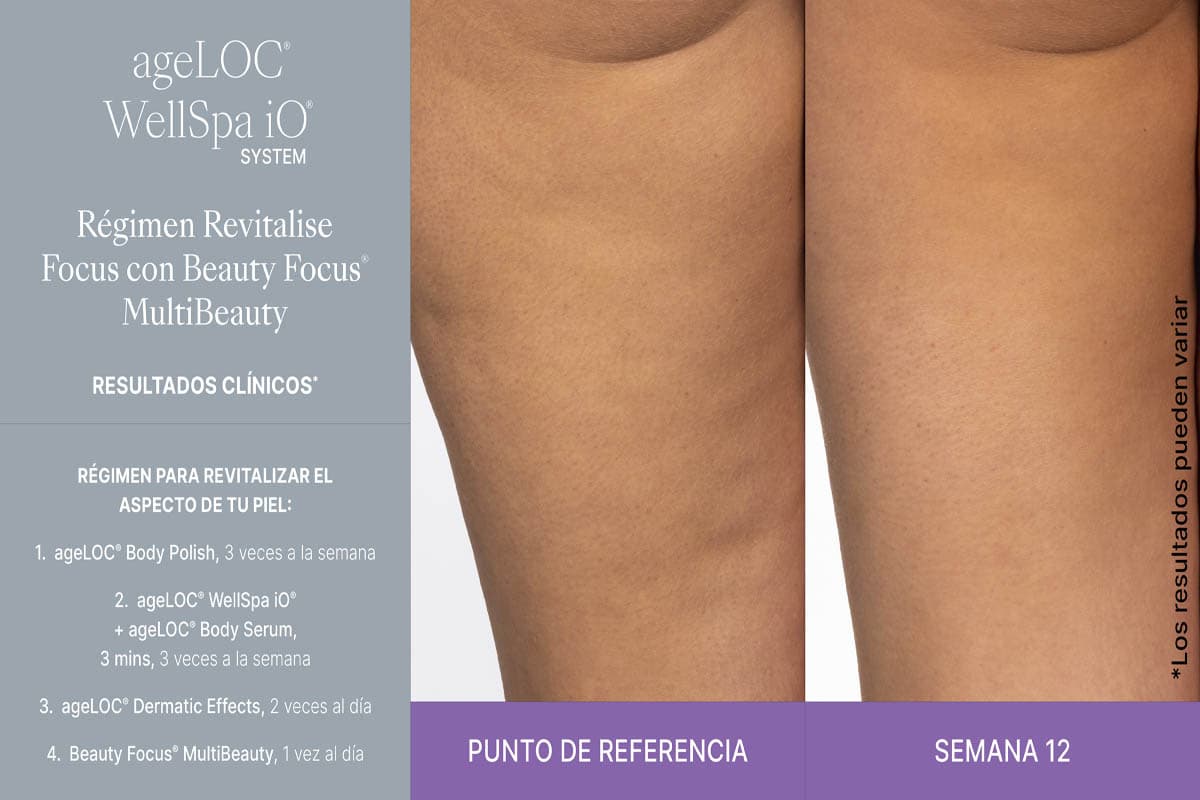 Reducción visible de celulitis y mayor uniformidad de la piel