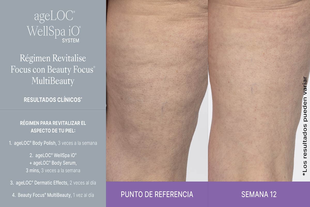 Mejora en firmeza y textura de la piel con WellSpa iO